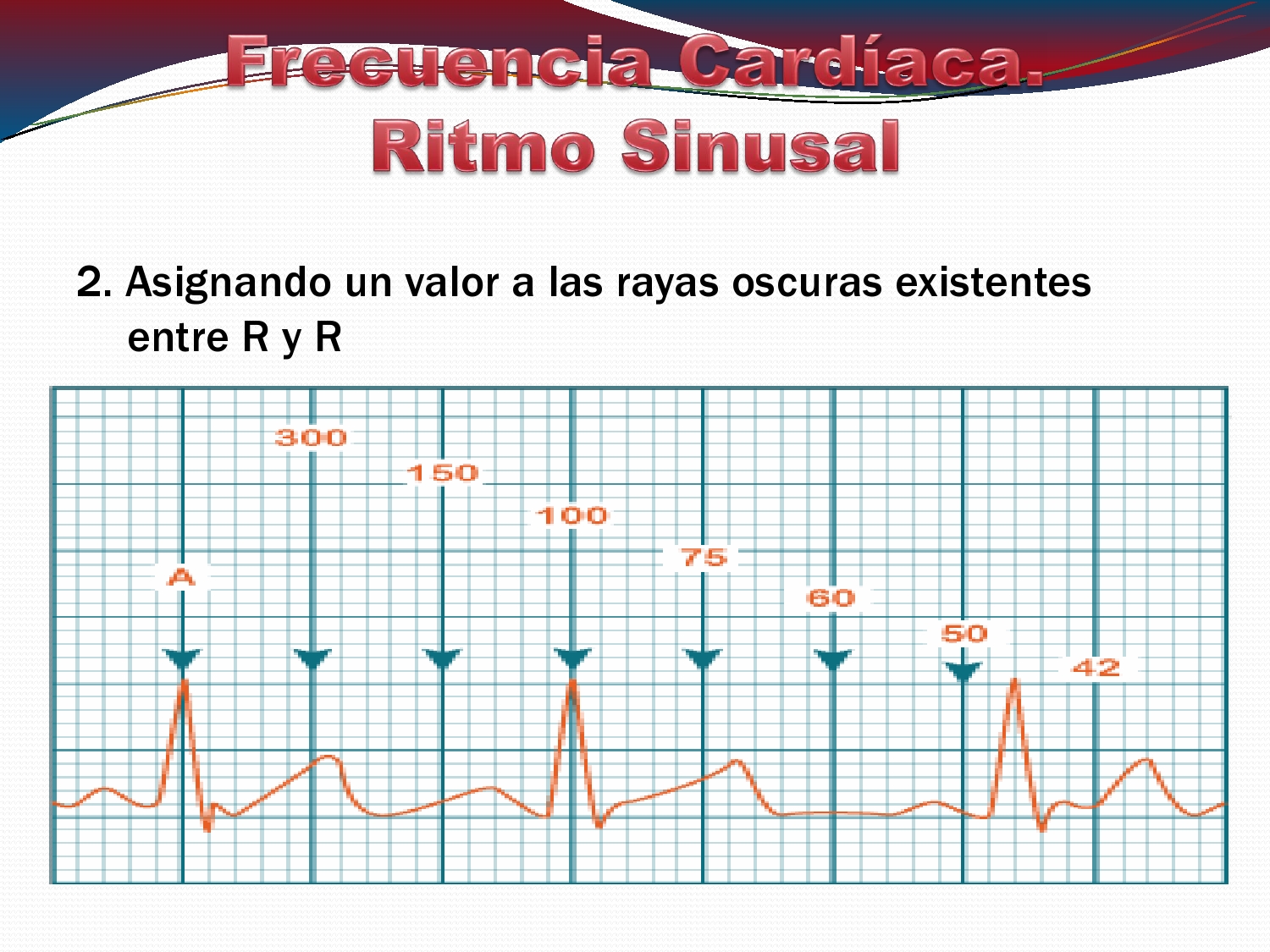 electrocardiograma