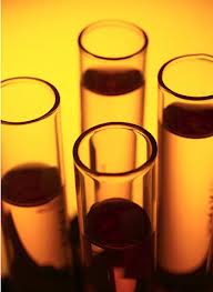 general urine examination