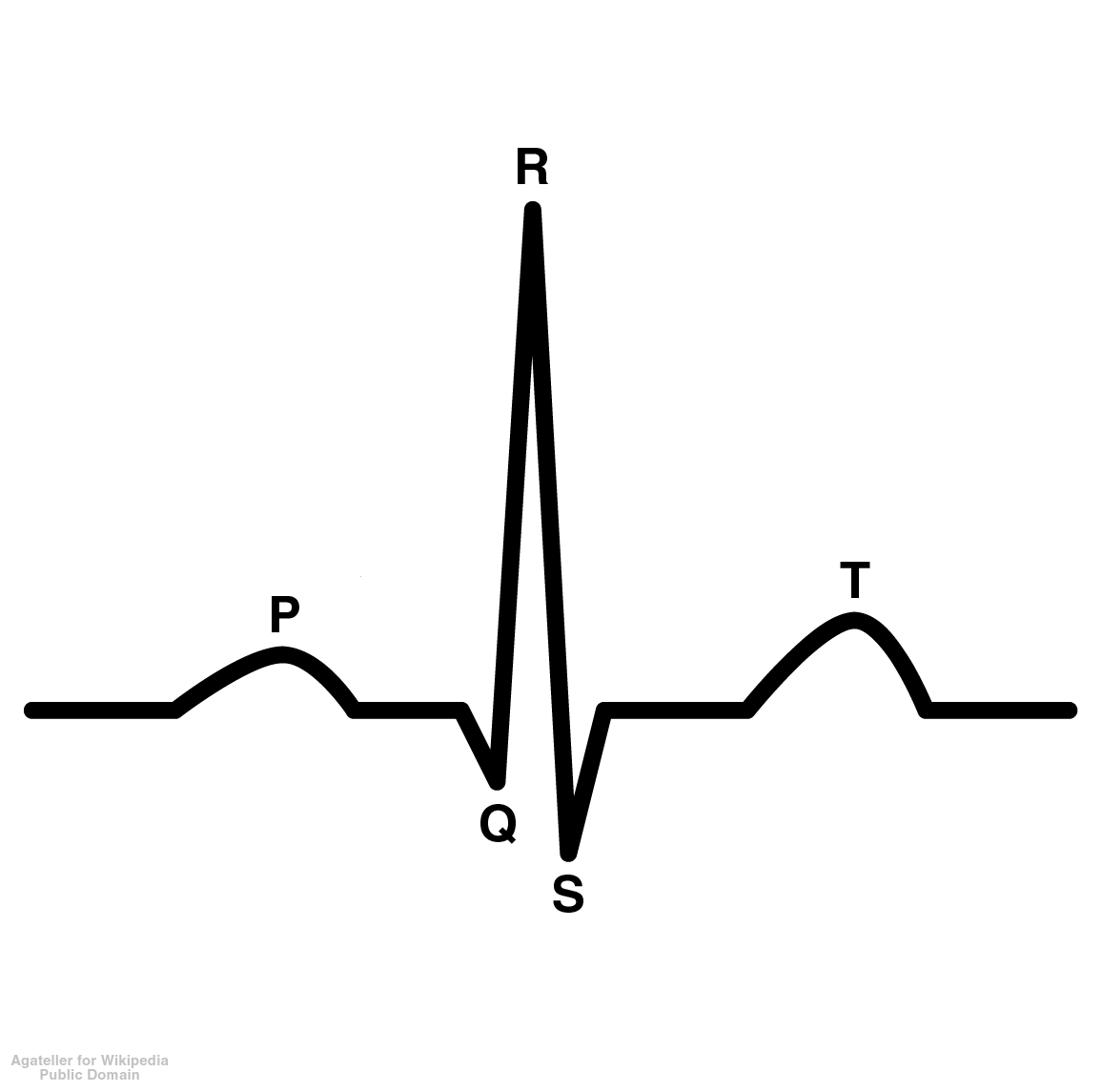 ekg